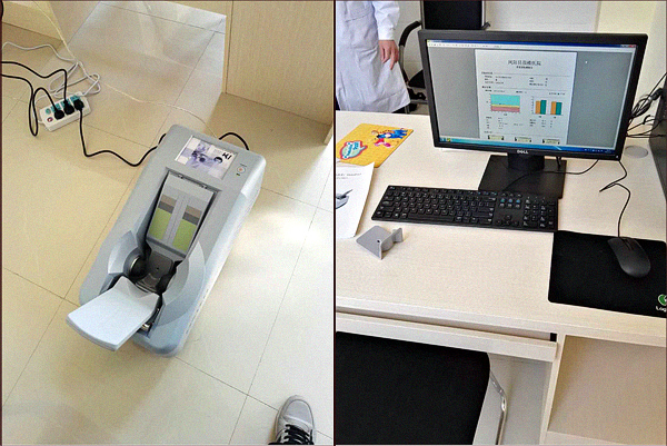 探花视频在线检测仪检测骨质疏松的真面目,探花视频在线健康值