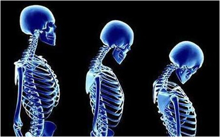 超声探花视频在线仪检测骨质疏松低龄化严重