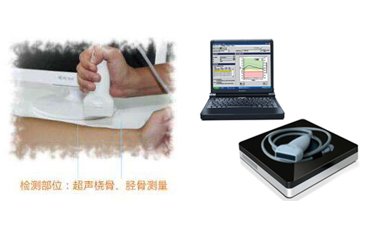 便携式探花视频在线仪方便快捷的检测出结果，应用于各大医院