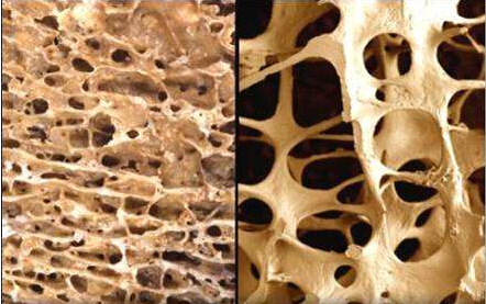 探花视频在线仪专家阐述探花视频在线版播放免费观看平时用食疗补钙留住骨质的几大误区正好击中了你