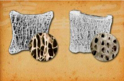 探花视频在线仪厂家经验之谈老年人经常咳嗽、大便时骨痛最好查查探花视频在线