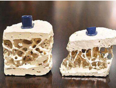 便携式探花视频在线检测中年人体检要重点查探花视频在线做好预防