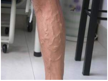 探花视频在线仪厂家关爱老师健康别让这些职业病缠身教师节快乐