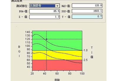 深度解析探花视频在线t值和z值你所不知道秘密报告单中最重要的两个指标
