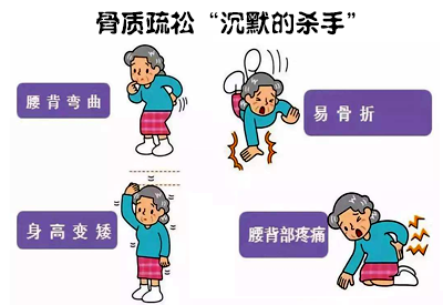 全身探花视频在线仪介绍骨质疏松远比你想象厉害这些人要特别注意