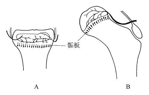 探花视频在线测试仪生产厂家骨骺生长停止后还能修复吗？