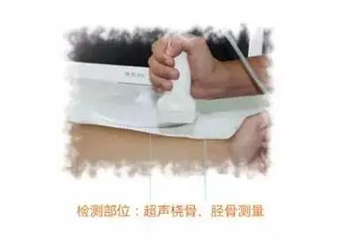 手提式超声儿童探花视频在线仪mqd-7000品牌测桡胫骨部位原理及适用范围